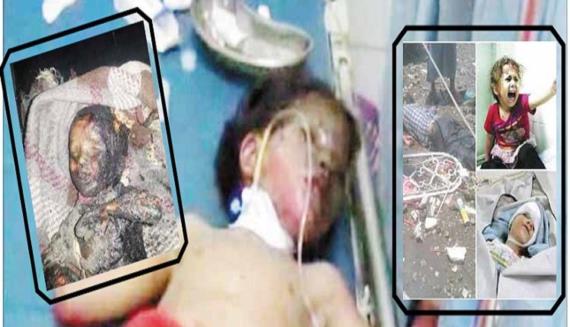 13ألف طفل يمني ضحايا العدوان خلال ست سنوات 