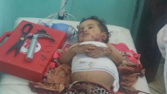 طيران العدوان يستهدف سيارة مواطنين في مديرية الصفراء بمحافظة صعده