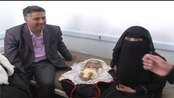.وفد إعلامي وحقوقي يزور حالات التشوه الخلقي في مستشفى السبعين بصنعاء