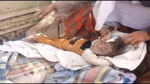 استشهاد امرأتين وطفلين أحدهما رضيع في غارة للعدوان على منزل بصرواح
