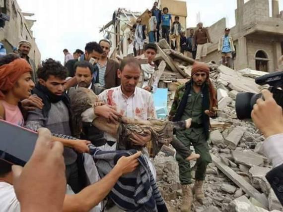 القائم بأعمال سفارة فلسطين: الدم الفلسطيني يمتزج بالدم اليمني في مجزرة عطان