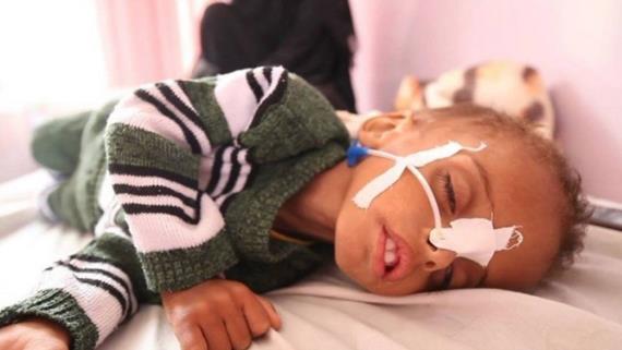 وزارة الصحة تكشف أرقام كارثية عن الوضع الصحي في اليمن بسبب العدوان والحصار