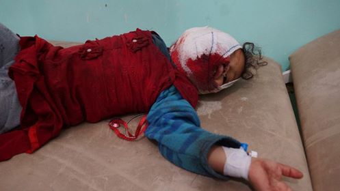 إصابة طفلة ومواطنين اثنين بجروح في قصف سعودي على صعدة