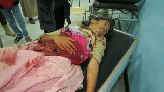 استشهاد طفلة بغارة لطيران العدوان على محافظة حجة (صور)