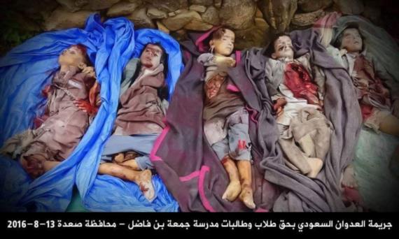 حقوق الإنسان : سنحرك ملفات جرائم تحالف العدوان على مستوى دولي