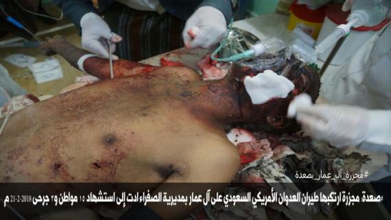 18 شهيدا وجريح في غارة للعدوان على مديرية الصفراء بصعدة