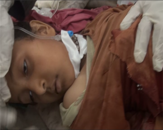 إصابة امرأة وطفلين إثر غارة لطيران العدوان على رازح بصعدة