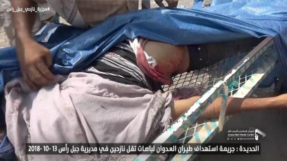 وزارة حقوق الإنسان تدين مجزرة العدوان في جبل راس بالحديدة