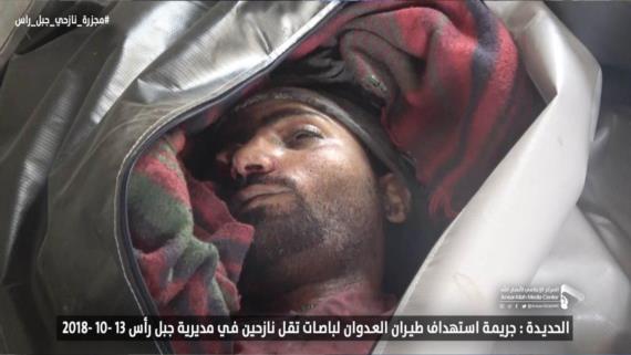 أكثر من 49 شهيدا وجريحا حصيلة جديدة لمجزرة العدوان بحق النازحين بالحديدة
