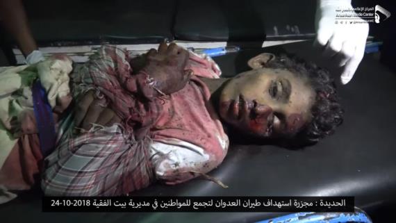 الخارجية تدين استمرار تحالف العدوان بارتكاب جرائم الحرب في اليمن