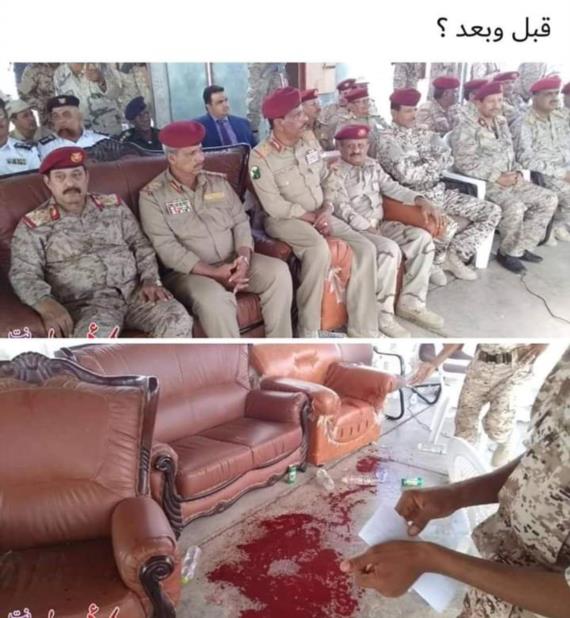 أنباء عن مصرع نائب رئيس هيئة أركان المرتزِقة متأثراً بهجوم العند