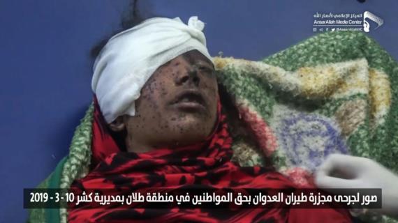 اللجنة المنظمة تدعو للمشاركة في تشييع شهداء مجزرة العدوان بكشر