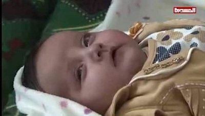 وفاة الطفلة أميرة الزايدي بعد منع العدوان الغاشم لسفرها للعلاج بالخارج