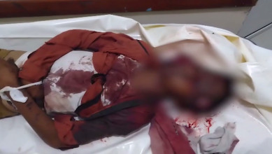 385 شهيدًا وجريحًا ضحايا العدوان السعودي منذ الثالث من سبتمبر الماضي