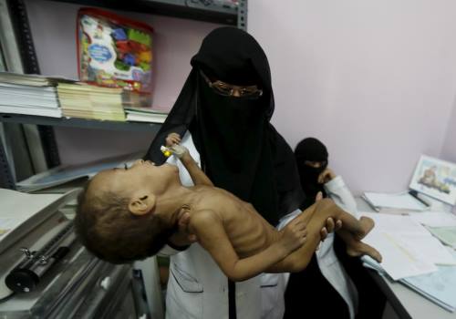 المجاعة والقتل استراتيجية مُمنهجة للعدوان السعودي على اليمن